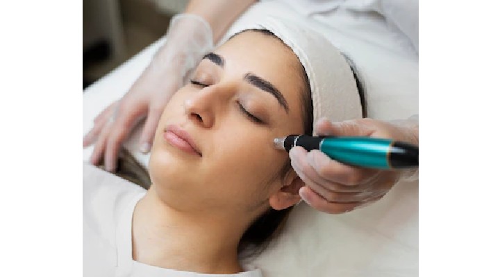 needling2.jpg